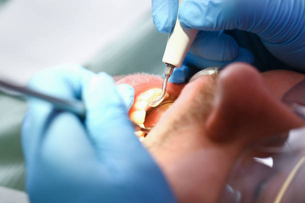 Best Emergency Cosmetic Dentistry (e.g., broken veneers) in Peebles, OH