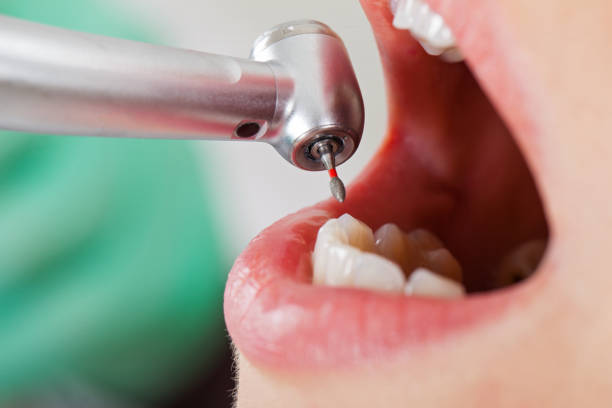 Best Emergency Treatment for Oral Infections in Peebles, OH